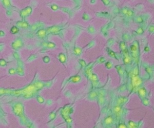 Stain-free phase-contrast microscopy with live cells highlighted in green