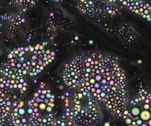 Fluorescence microscopy of cells with phenotype markers detected as coloured dots