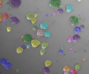 Suspension culture microscopy with cell aggregates segmented in colour